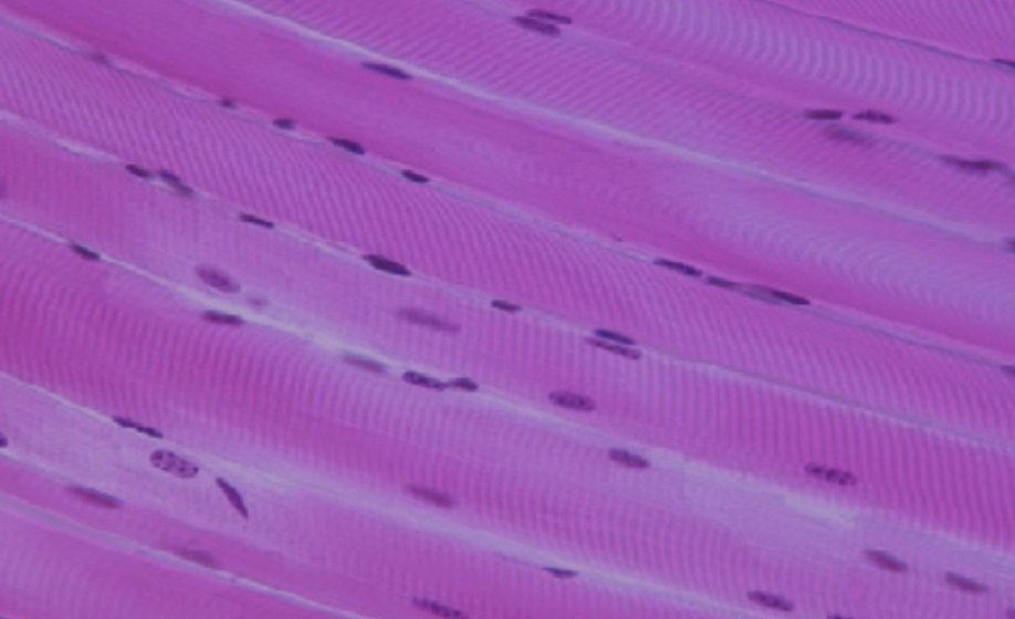 WEBINAR - Beyond Isometric Twitch - Aurora Scientific