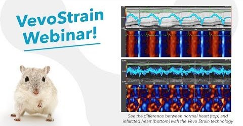 WEBINAR REVIEW: Understanding Subtle Cardiac Changes by Fujifilm VisualSonics
