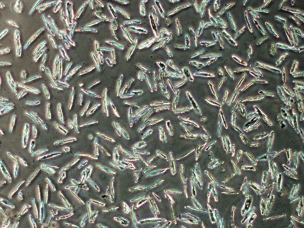 InsideAnswers: Techniques and Best Practices for Cardiomyocyte Isolation