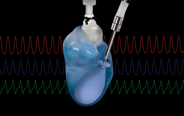 An Introduction to Isolated Langendorff Heart: Experimental Considerations and Best Practices