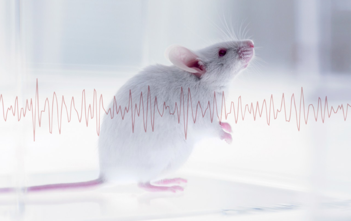 Measuring EEG in vivo for Preclinical Evaluation of Sleep and Alzheimer’s Disease