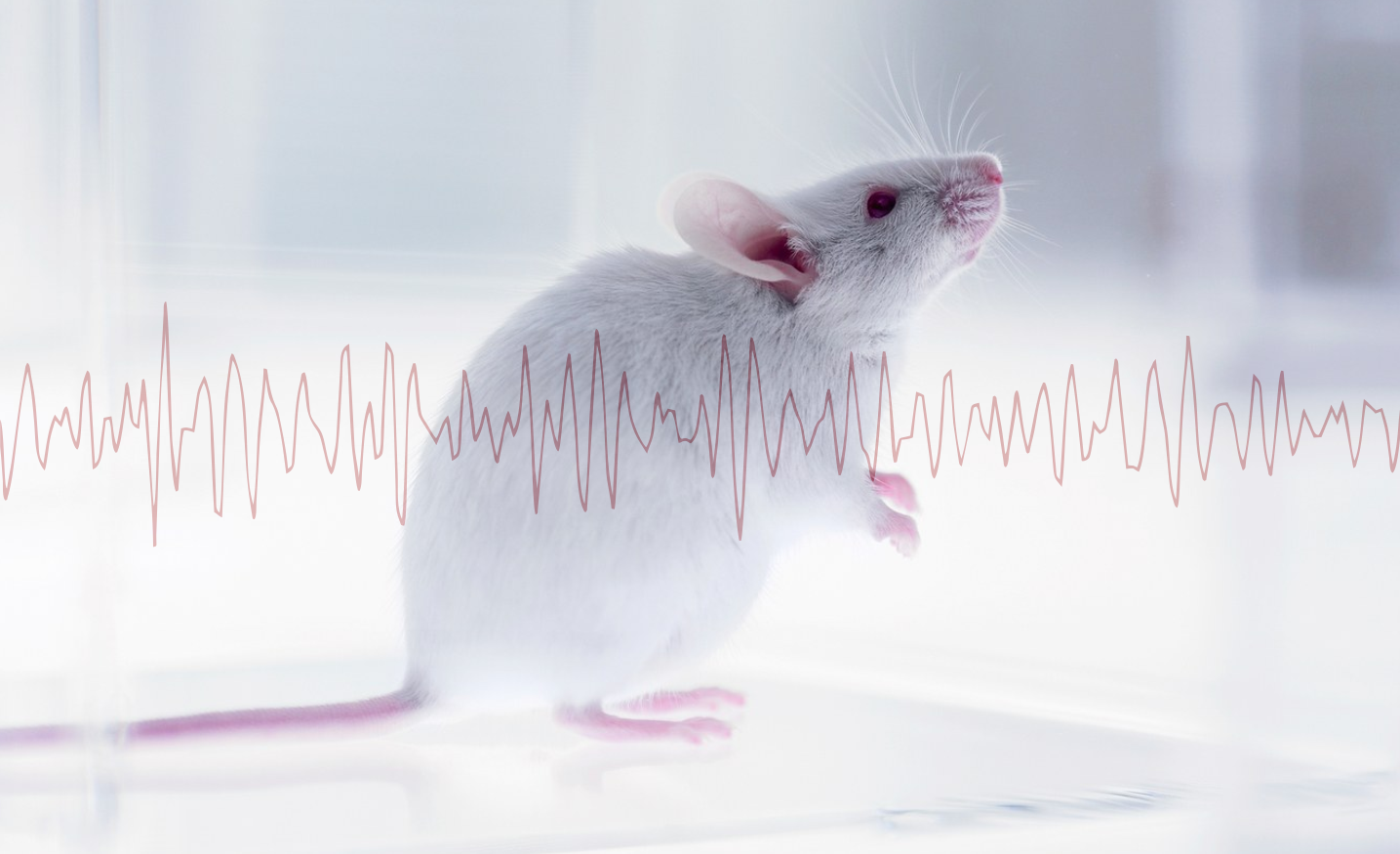 Measuring EEG in vivo for Preclinical Evaluation of Sleep and Alzheimer’s Disease