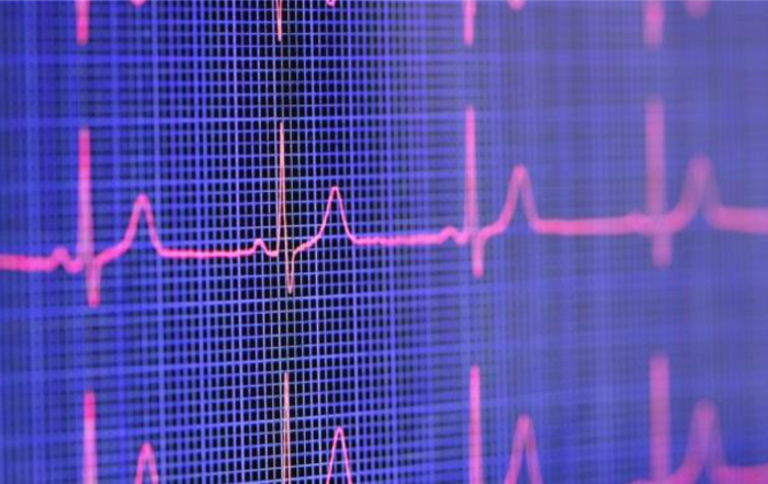 Utilizing Heart Rate Variability (HRV) for Preclinical Evaluation of Cardiovascular Function & Related Disease