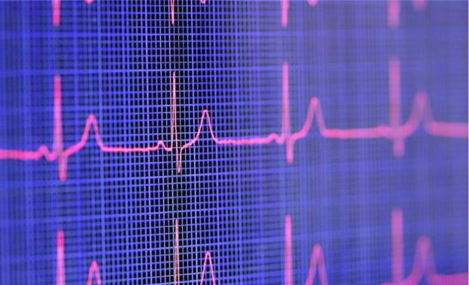 Utilizing Heart Rate Variability (HRV) for Preclinical Evaluation of Cardiovascular Function & Related Disease