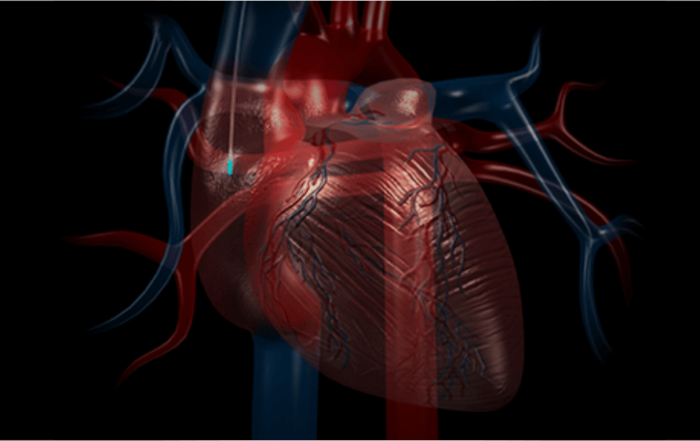 Don’t Miss a Beat: Understanding Continuous, Real Time Physiologic Monitoring