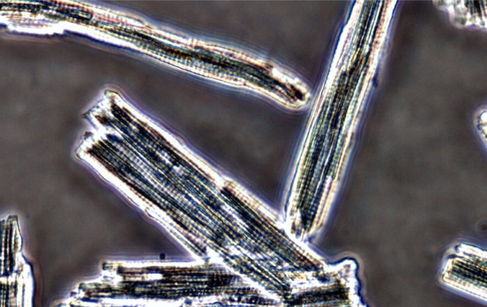Techniques and Best Practices for Cardiomyocyte Isolation