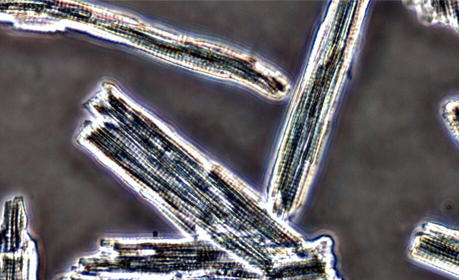 Techniques and Best Practices for Cardiomyocyte Isolation