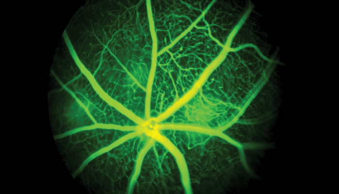 Optimizing Image-Guided Laser-Induced Choroidal Neovascularization in Mice
