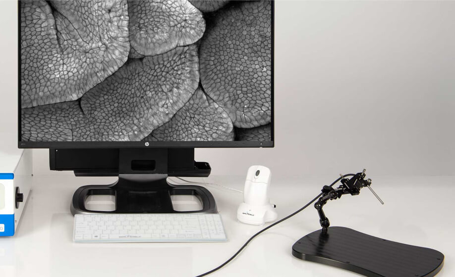 Preclinical Imaging with Fluorescence In Vivo Endomicroscopy