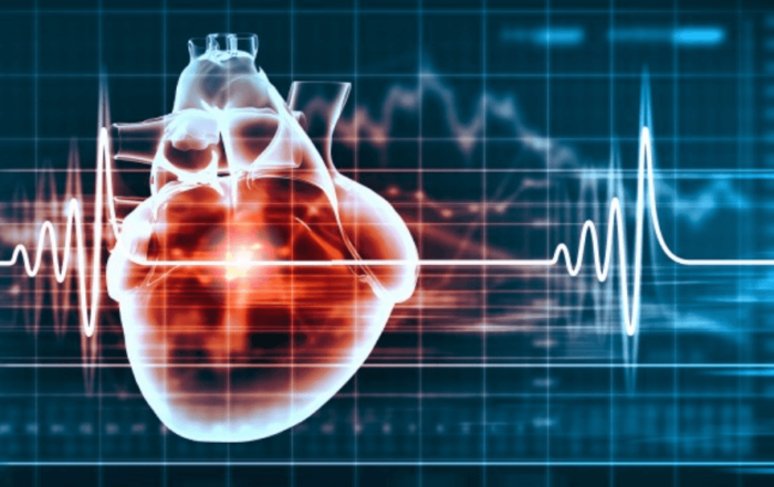 Hemodynamic Assessment: Pressure-Volume Loop Case Studies