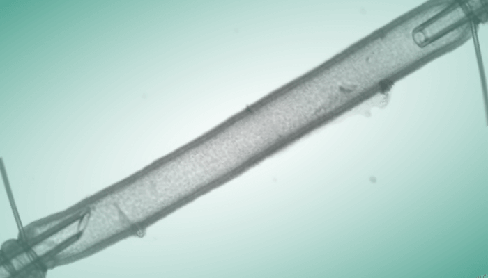 Studying Flow Mediated Responses in Isolated Vasculature