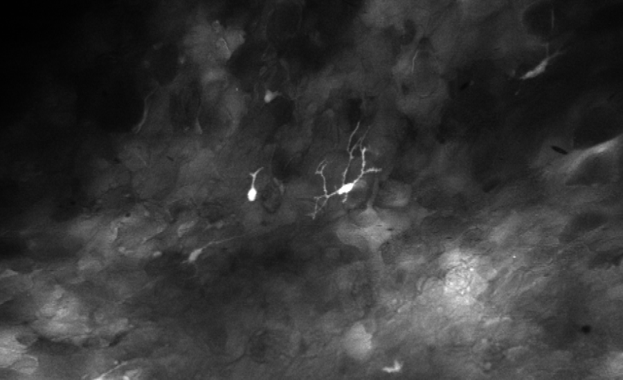 Advances in Sub-cellular and Cellular in vivo Imaging for Systems Biology