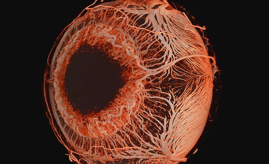 Ex Vivo MicroangioCT: Advances in Microvascular Imaging