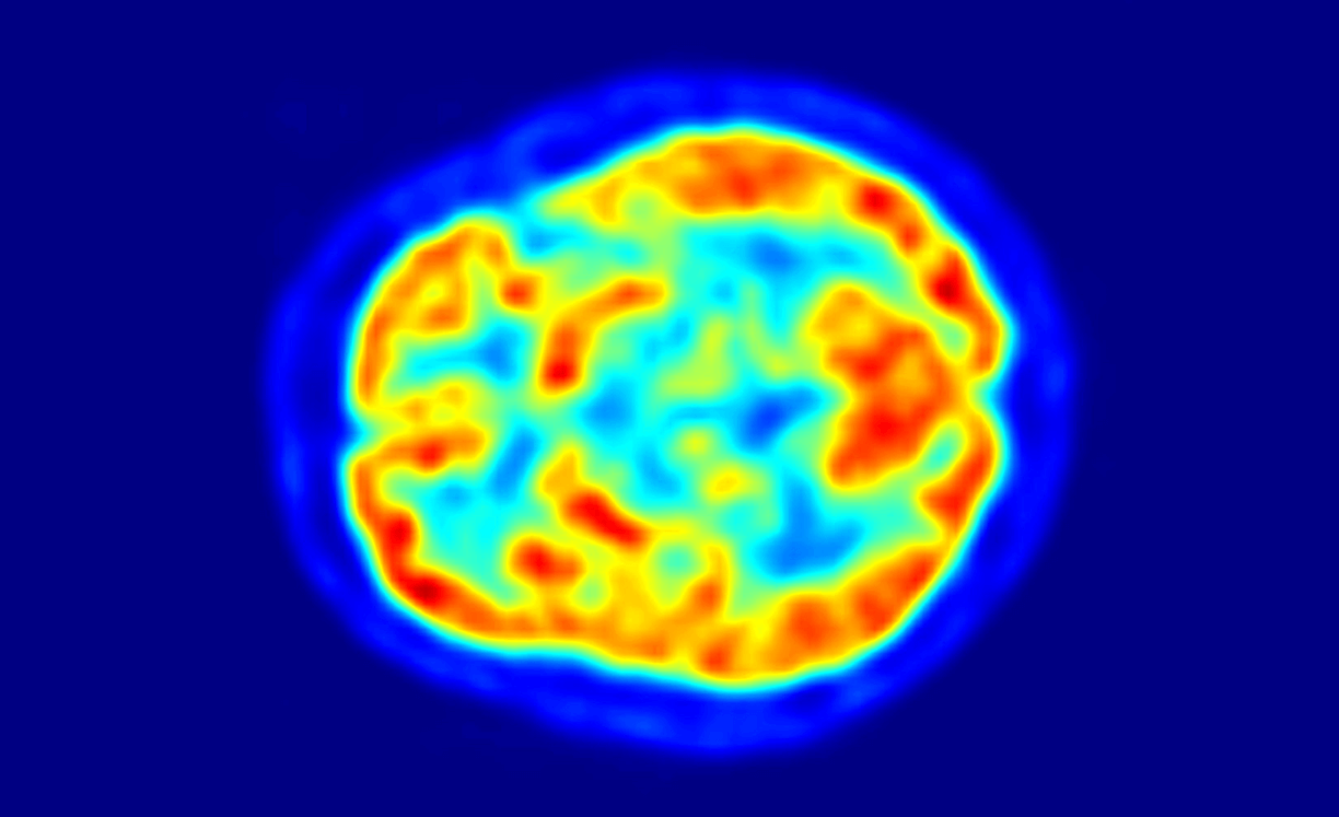 Scintica PET Neuroscience