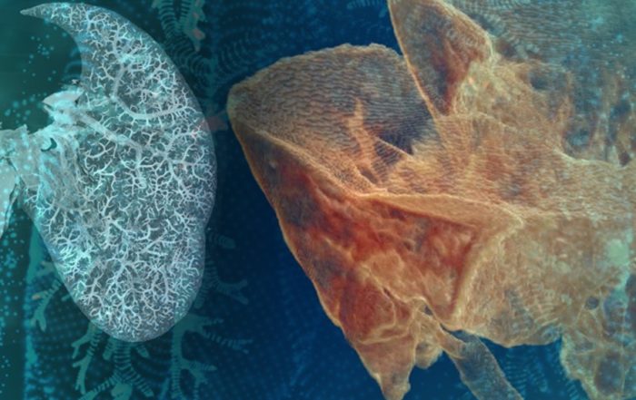 MicroCT Applications in Lung Research and Immunology