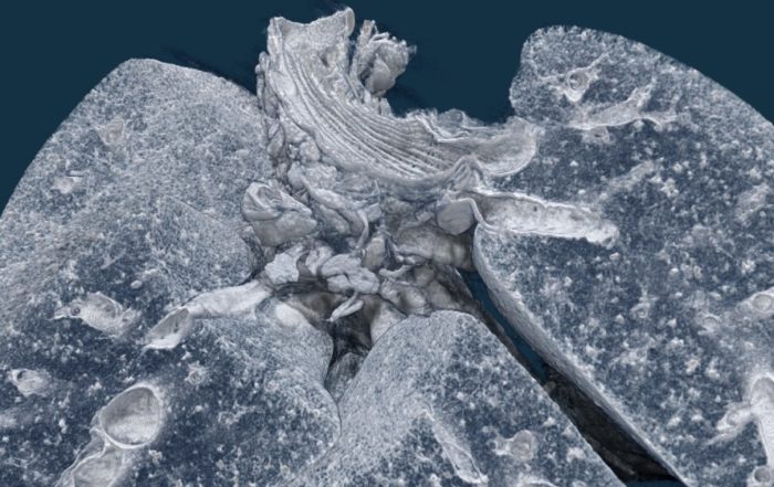 Micro-CT: Fancy gadget or indispensable technology towards accurate quantification of lung disease and therapy?