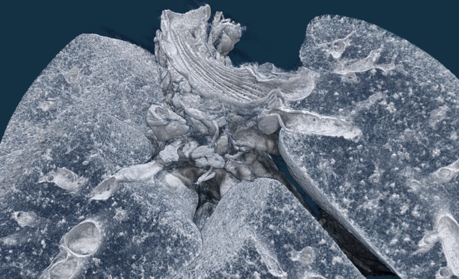 Micro-CT: Fancy gadget or indispensable technology towards accurate quantification of lung disease and therapy?