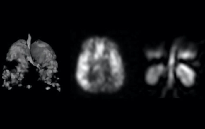 Clinical Methods and Applications of Hyperpolarized 129Xe MRI for Functional Imaging of the Lungs and Other Organs