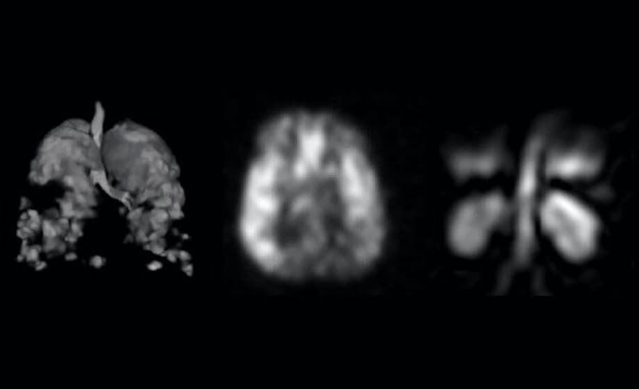 Methods and Applications of Hyperpolarized 129Xe MRI for Functional Imaging of the Lungs and Other Organs