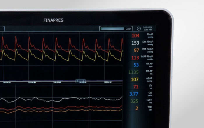 Cardiovascular Autonomic Testing Revisited