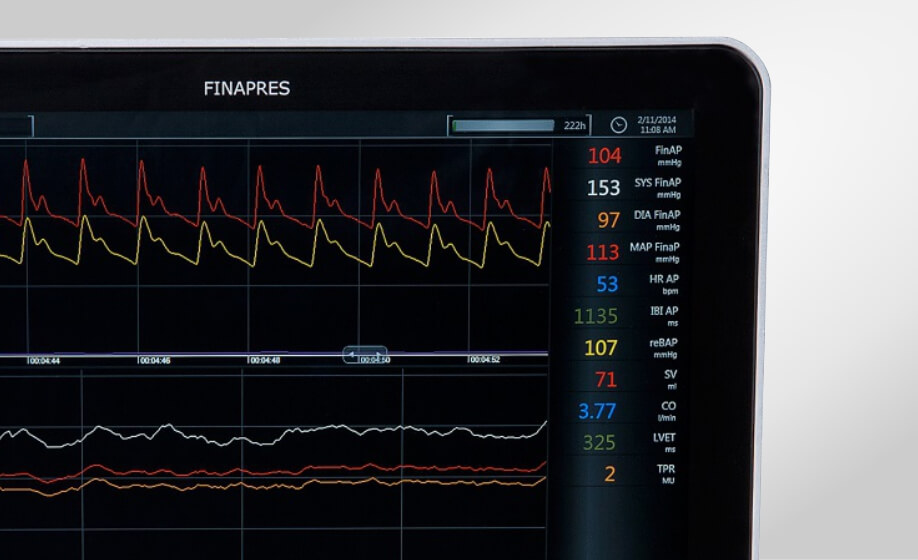 WEBINAR - Cardiovascular Autonomic Testing Revisited