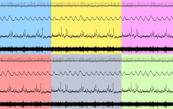 Data Collection & Analysis in Human Autonomic Research: How to Guide to Successful Testing