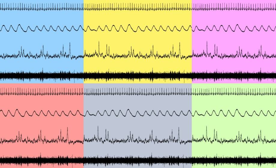 Data Collection & Analysis in Human Autonomic Research: How to Guide Successful Testing