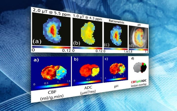 Introduction to CEST for MRI Assessment of Brain Ischemia and Cancer Lesions