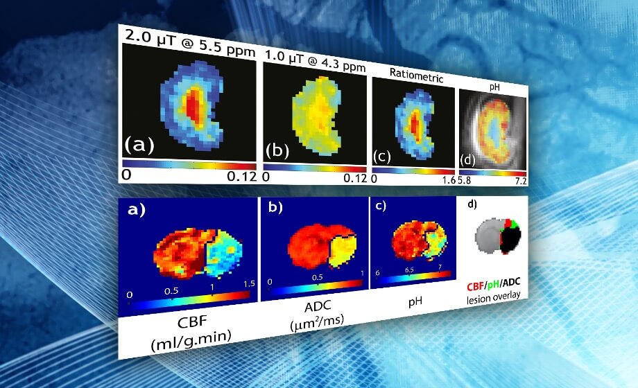 WEBINAR - Introduction to CEST for MRI Assessment of Brain Ischemia and Cancer Lesions