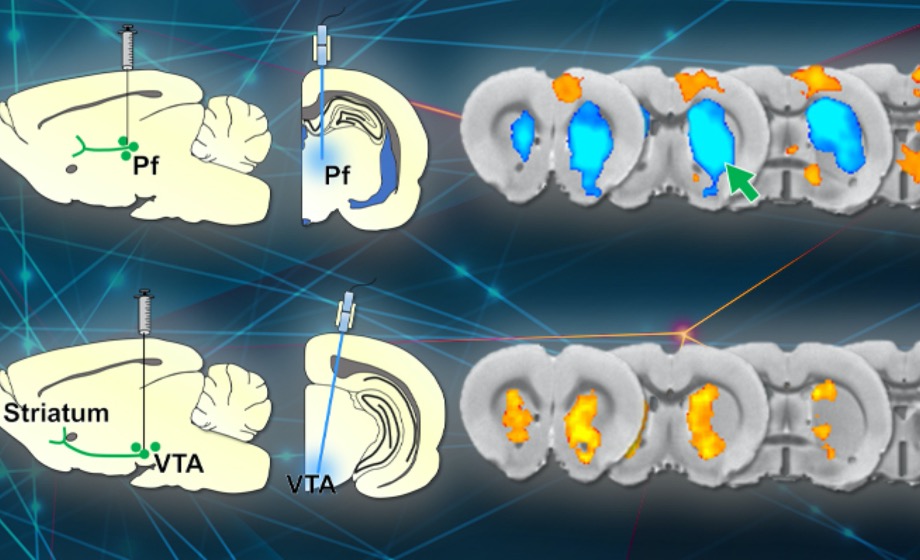 Stimulating and Recording Neuronal Activity During Traditional fMRI, and the Benefits When Doing This at “Zero” Echo Time