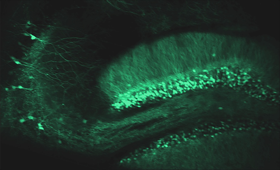 Hippocampal Neural Circuits in Awake Head-Fixed Mice Navigating a Real-World Environment