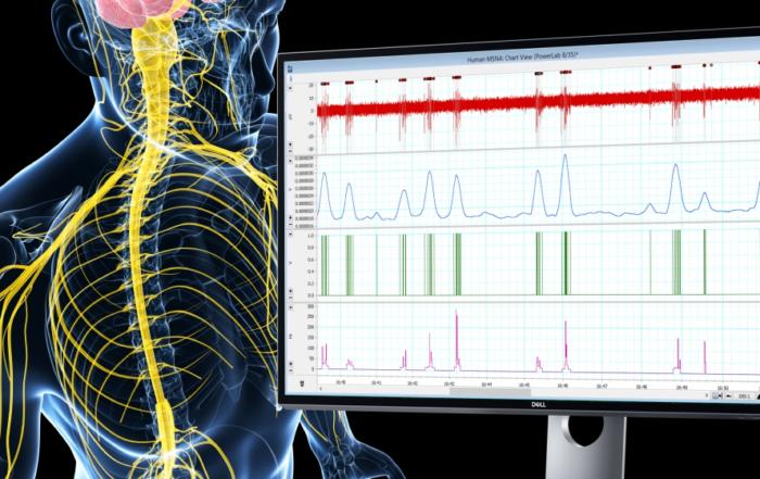 Measuring and Quantifying Sympathetic Control of the Cutaneous Microvasculature