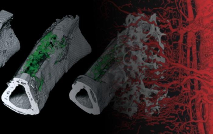 High-Resolution Exploration of ECM-based Vascularized Tissue-Flaps