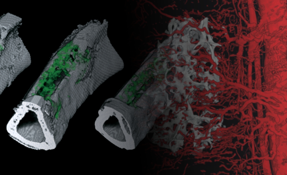 High-Resolution Exploration of ECM-based Vascularized Tissue-Flaps