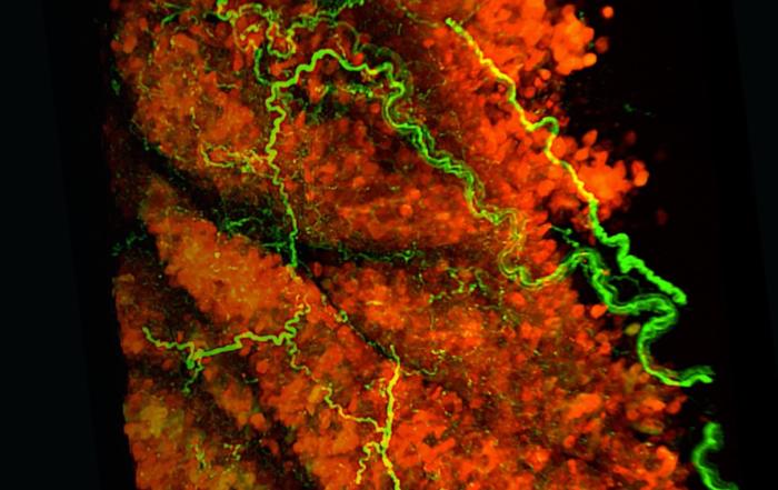 CRISPR-Enhanced Adipocyte Browning: A Cell Therapy Approach to Treat Metabolic Disease