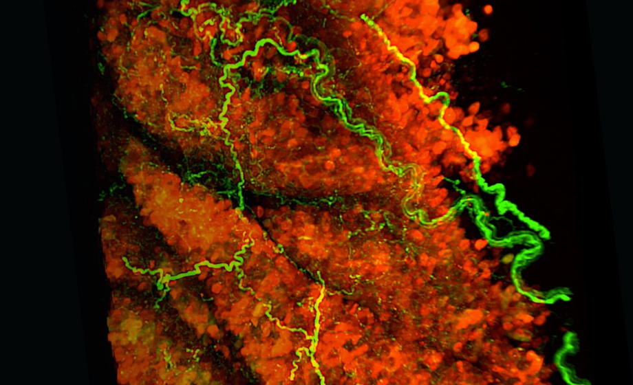 CRISPR-Enhanced-Adipocyte-Browning-A-Cell-Therapy-Approach-to-Treat-Metabolic-Disease