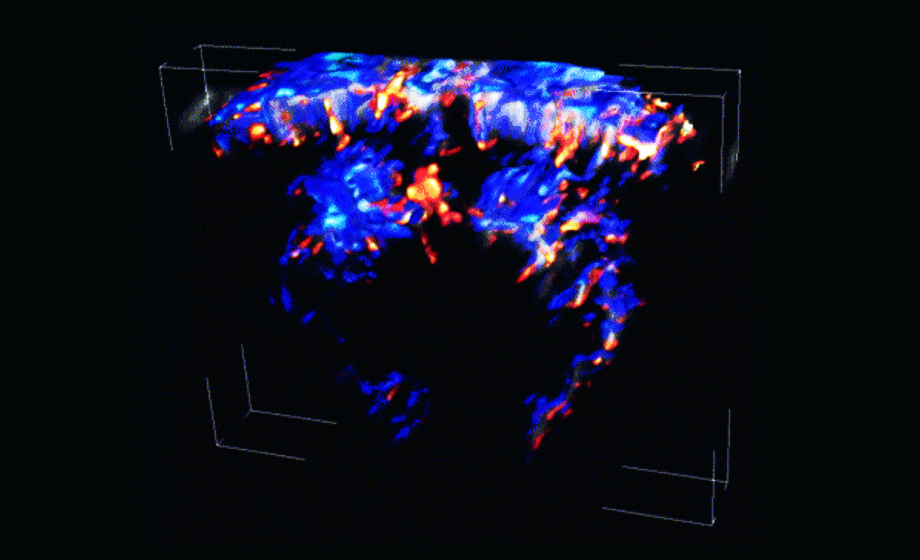 Functional Ultrasound Imaging in Pain and Pharmacology Research
