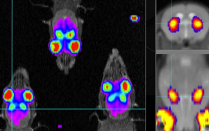 PET/MRI Occupancy Studies – Basic Principles and Applications in Neuroimaging