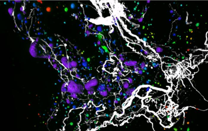 Remodeling of Pancreatic Innervation in Diabetes