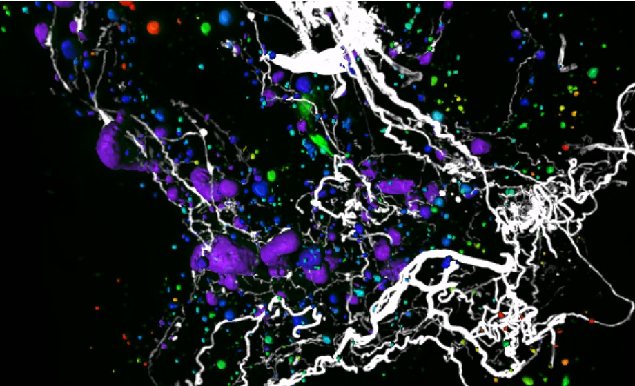 Remodeling of Pancreatic Innervation in Diabetes