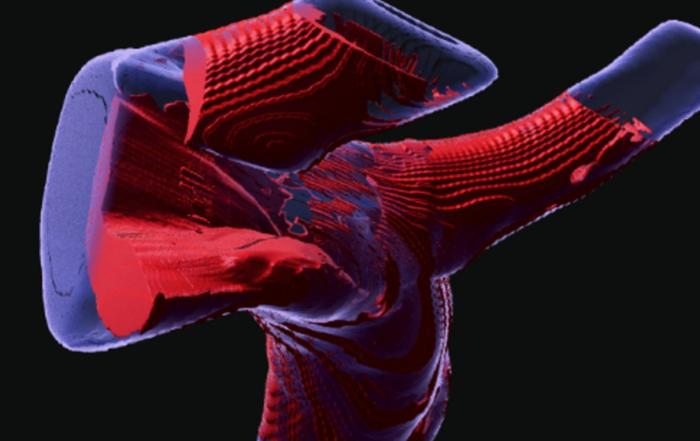 Old Dogs Benefit From New Tricks: 3D Analysis of Arterial Injury to Study Nrf2-Dependent Inhibition of Neointimal Hyperplasia in Rats