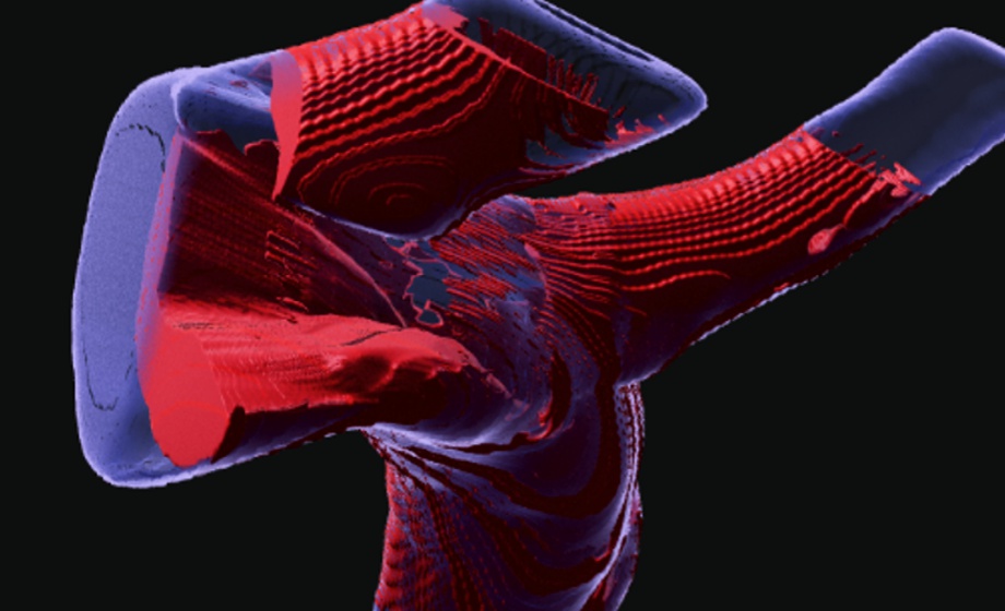 3D Analysis of Arterial Injury to Study Nrf2-Dependent Inhibition of Neointimal Hyperplasia in Rats