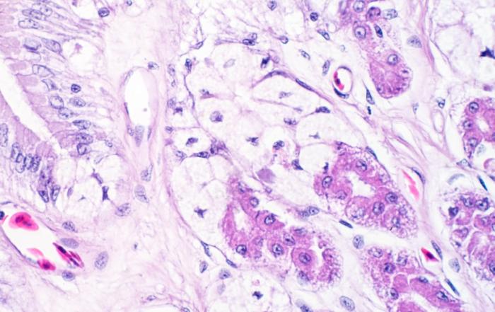 Cutting Edge Conversations: Challenges in Sourcing Human Biosamples