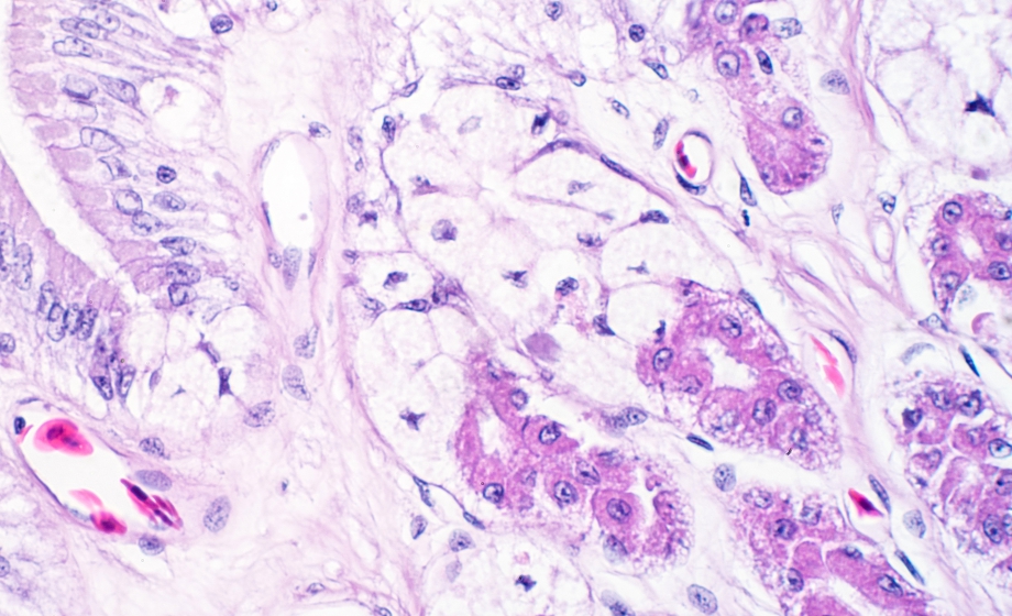 Cutting Edge Conversation: Challenges in Sourcing Human Biosamples
