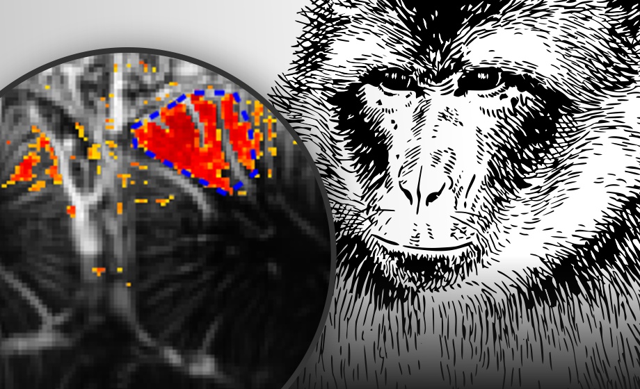 Functional Ultrasound Neuroimaging in Awake & Behaving Non-Human Primates