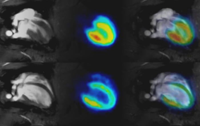 Cardiac PET/MR Imaging in Small Rodents