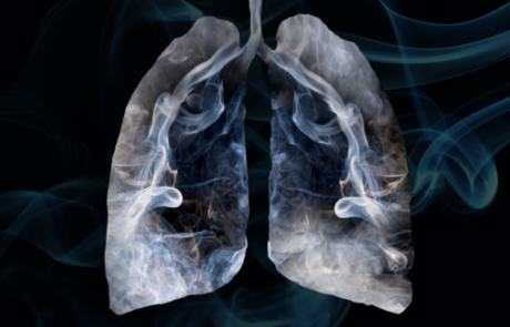 Assessing Toxicity and Health Risks of E-cigarettes: How to Take Aim at a Moving Target