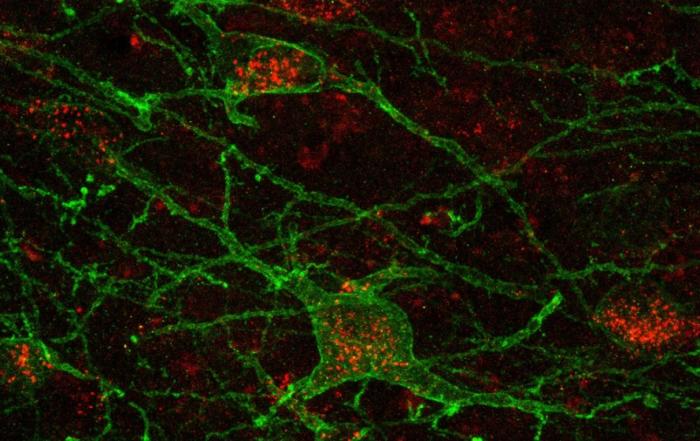 Sex Differences in Fear Memory