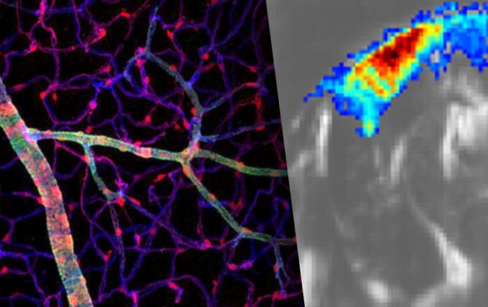 Microvascular & Functional Ultrasound Imaging: Insights into Stroke and Neurovascular Diseases