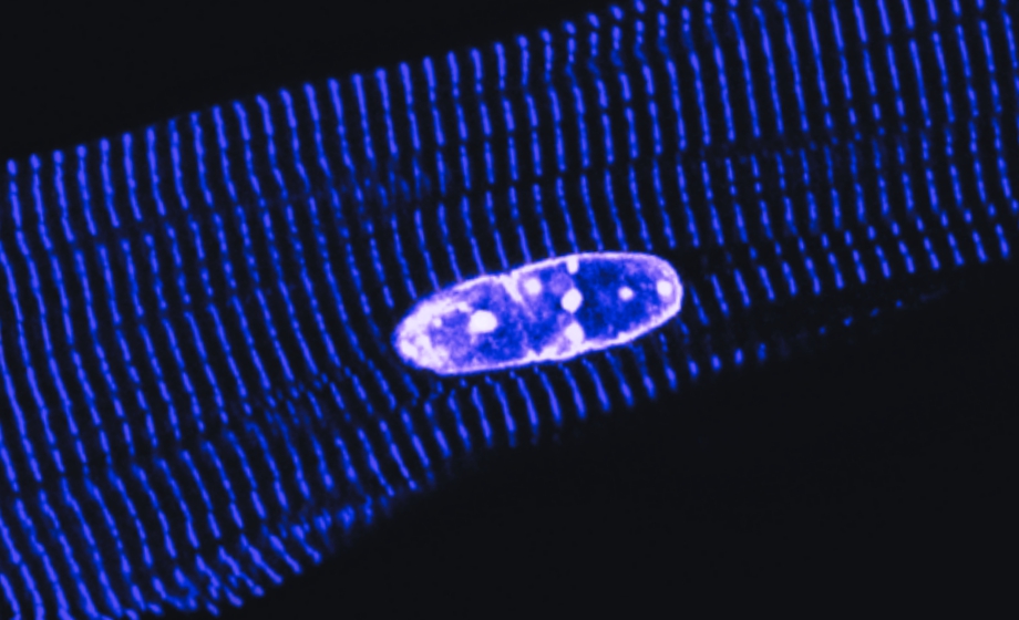 Understanding the Heart’s Intracellular Orchestra-Functional Characterization of Excitation-Contraction Coupling in Cardiomyocytes